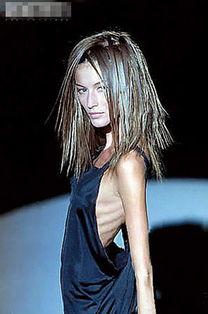 得厌食症的女明星